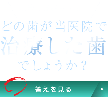 見分けられますか？どの歯が当医院で治療した歯でしょうか？（答えを見る）