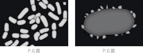 歯周病菌（P.G菌）イメージ