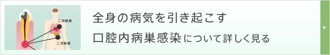 全身の病気を引き起こす口腔内病巣感染について詳しく見る