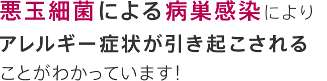 悪玉細菌による病巣感染により、アレルギー様症状が引き起こされることが分かっています！