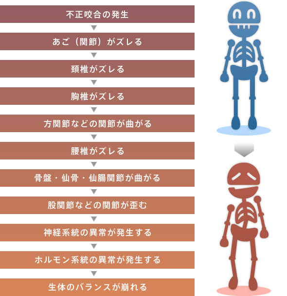 噛み合わせの不整合が全身に悪影響を及ぼします