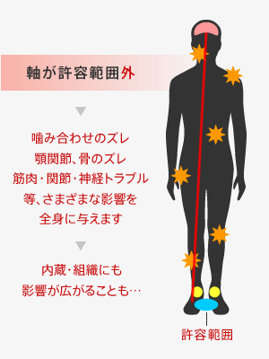 軸が許容範囲外の場合、噛み合わせのズレ顎関節、骨のズレ筋肉・関節・神経トラブル等、さまざまな影響を全身に与えます