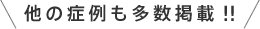 他の症例も多数掲載!!
