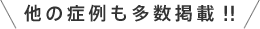 他の症例も多数掲載！！