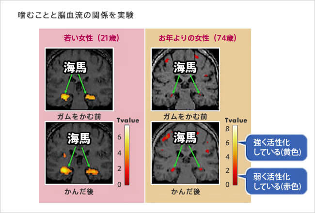 噛むことと脳血流の関係を実験