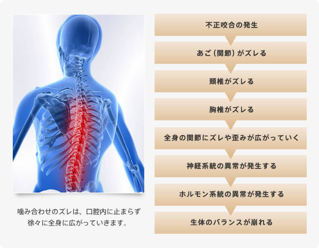 噛み合わせのズレは、口腔内に止まらず徐々に全身に広がっていきます。