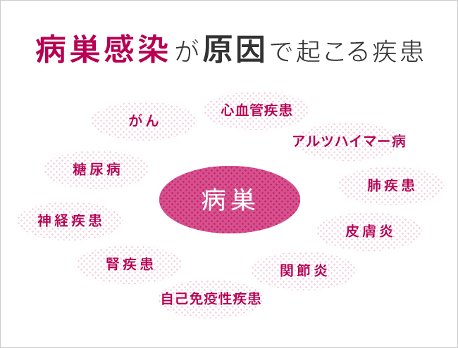 病巣感染が原因で起こる疾患「心血管疾患」「アルツハイマー病」「肺疾患」「皮膚炎」「関節炎」「自己免疫性疾患」「腎疾患」「神経疾患」「糖尿病」「がん」