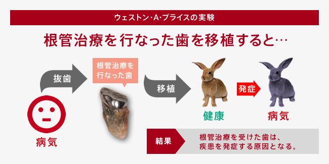 ウェストン・A・プライスの実験:根管治療を行なった歯を移植すると…。根管治療を受けた歯は、疾患を発症する原因となる。