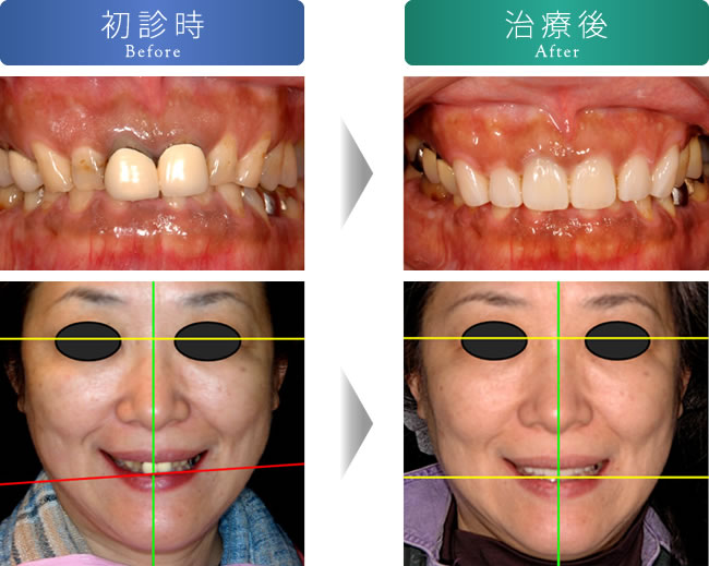 治療前後の写真