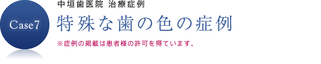 特殊な歯の色の症例