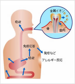 金属イオンが溶解し全身に行き渡るイメージ