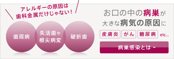 アレルギーの原因は歯科金属だけじゃない！お口の中の病巣が大きな病気の原因に…。病巣感染とは？