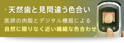 天然歯と見間違う色合い