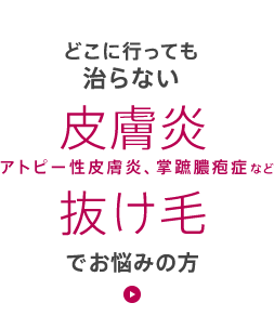 アトピー性皮膚炎、掌蹠膿疱症など皮膚炎。抜け毛でお悩みの方