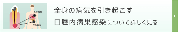 全身の病気を引き起こす口腔内病巣感染について詳しく見る