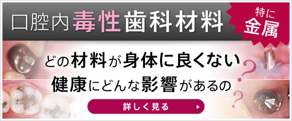 毒性歯科材料（特に金属）