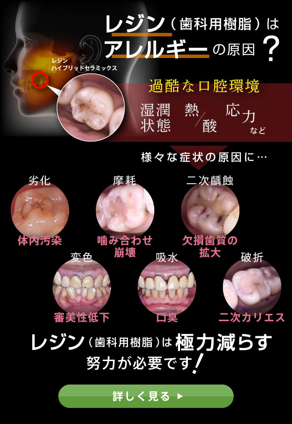 レジン（歯科用樹脂）はアレルギーの原因？レジン（歯科用樹脂）は極力減らす努力が必要です