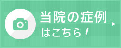 当院の症例