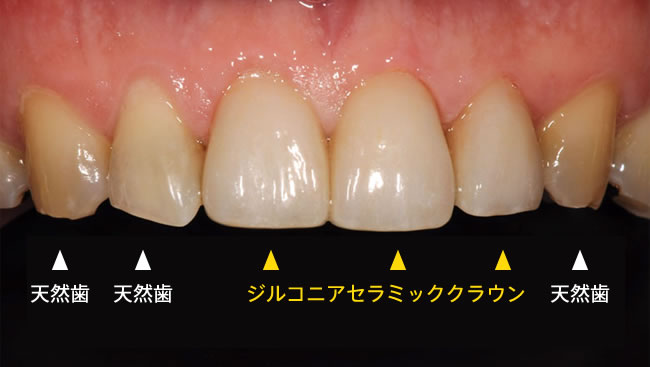 治療後イメージ