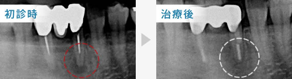 症例1