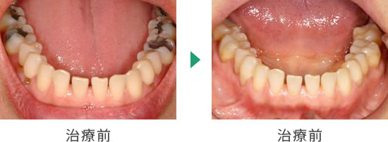治療前後のイメージ