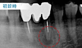 初診時