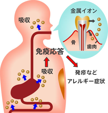 金属イオンが体内に吸収される仕組み