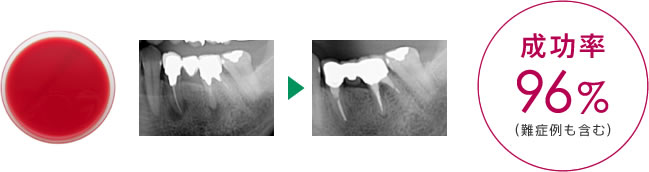 成功率96%（難症例も含む）