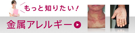 もっと知りたい！金属アレルギー