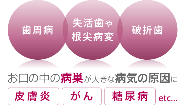 「歯周病」「失活歯や根尖病変」「破折歯」お口の中の病巣が大きな病気の原因に