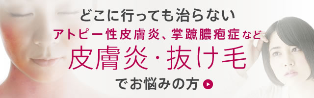 アトピー性皮膚炎、掌蹠膿疱症など皮膚炎・抜け毛でお悩みの方