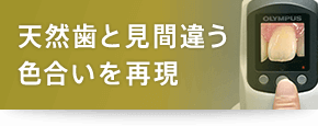 天然歯と見間違う色合い